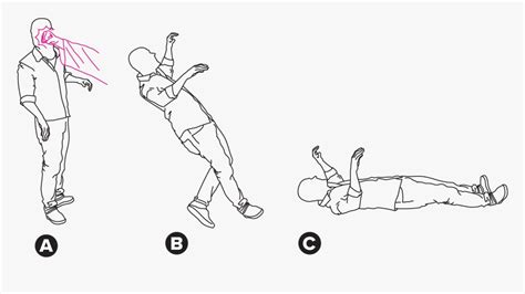 Fencing Posture Reflex