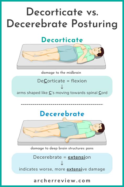 Fencing Response Vs Decorticate