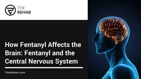 fentanyl effects on the nervous system