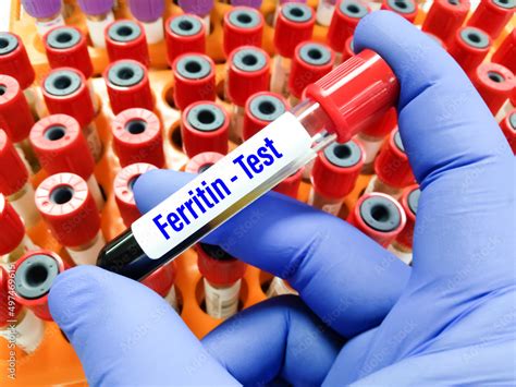 Ferritin Quest Test