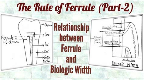 ferrule effect and biological width