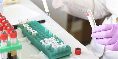 Fertility Test Galway