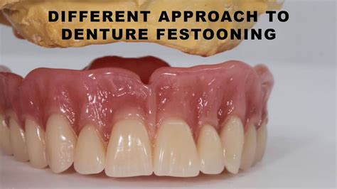 Festoon Dental