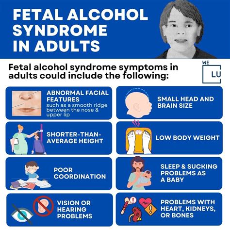 Pin on Fetal Alcohol Syndrome Disorder
