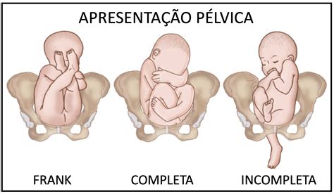 fetal foto