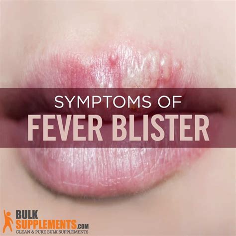 What Causes Fever Blisters on Lip and How to Get Rid of Them Fast