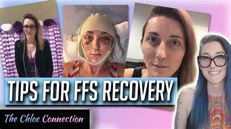 ffs surgery recovery