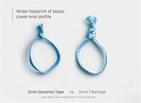 Fibertape Vs Suture Tape