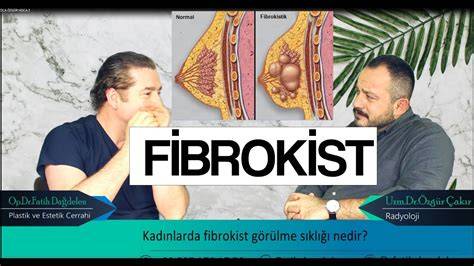 Fibrokistik meme nedir? Fibrokistik memenin 10 farklı belirtisi