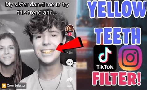 Filter Yellow Teeth