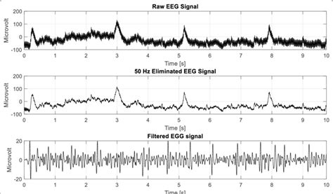 Filtering Eeg Data