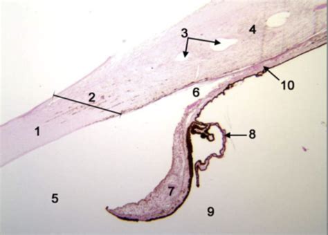 Filtration Angle Anatomy