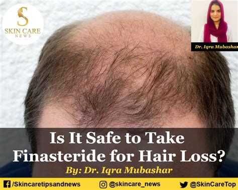 finasteride for hair loss prevention