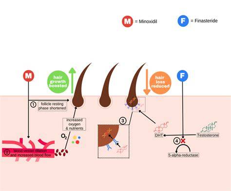 Finasteride Function