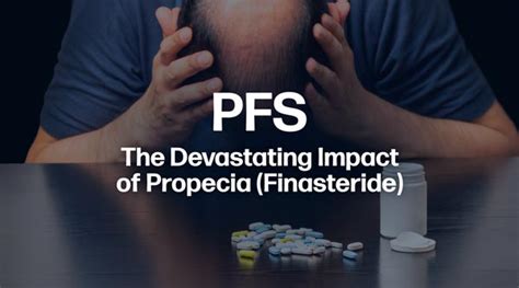 finasteride pfs
