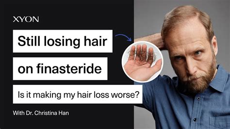 finasteride still losing hair