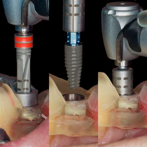 find implant dentistry courses
