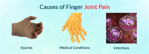 Finger Joint Issues