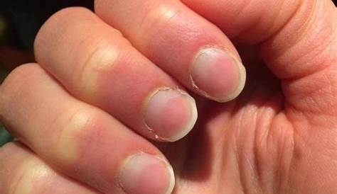 Fingernails Turning Dark Pink Hot Nails With Glitter Ring Finger Matte Hotpink