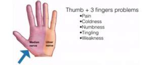 Fingers Cold Tingling