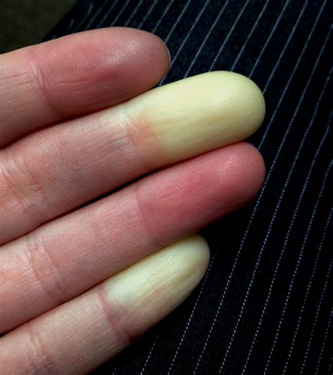 Fingertips Turn White