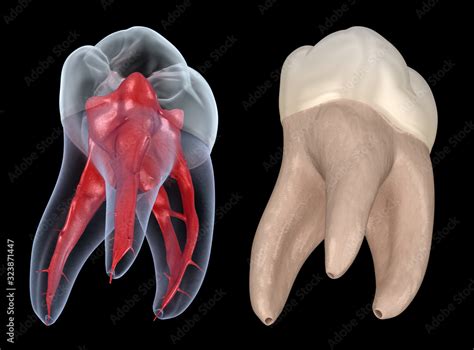 first molar teeth root