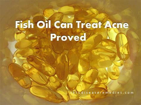 Fish Oils Acne
