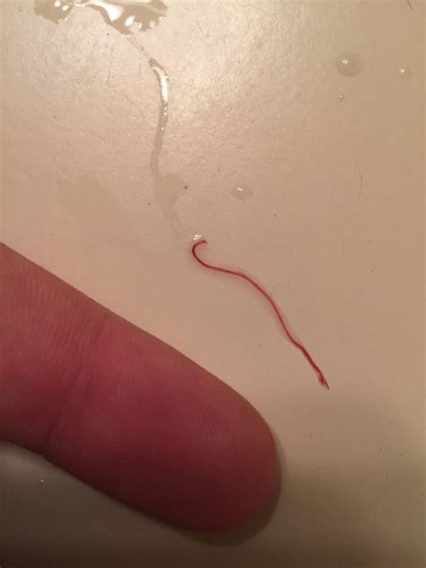 Fish Red Worm Anus