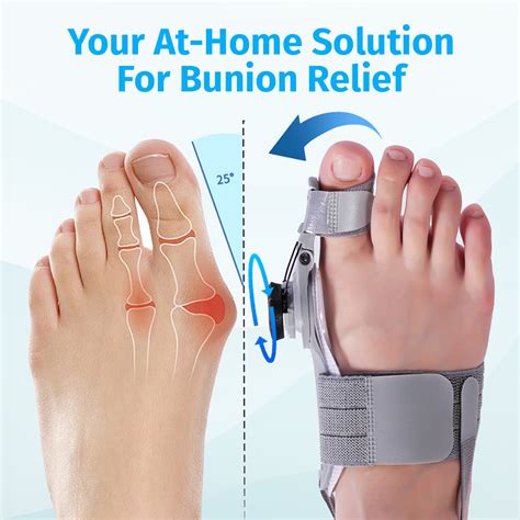 Fix Bunion Naturally