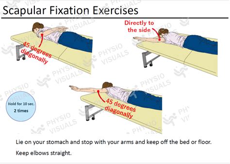 Fixation Exercises