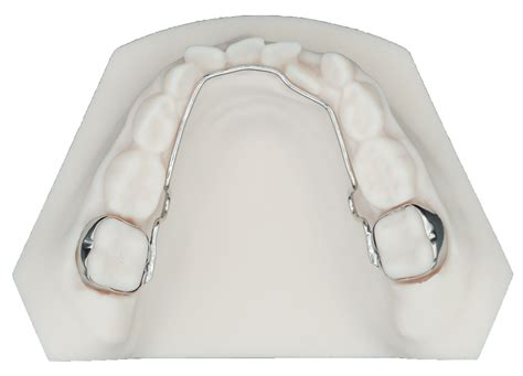 Fixed Bilateral Space Maintainer Code