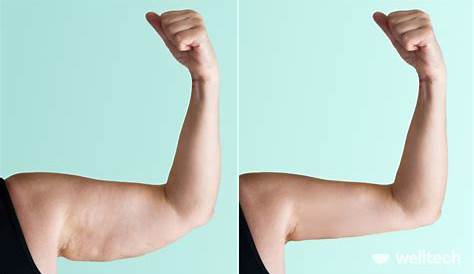 Flabby Arms Fat Or Skin Pin On Exercises