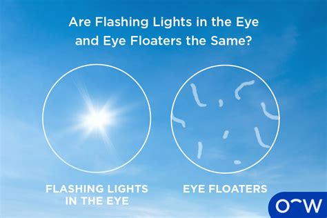 Flashing Lights In Eye Peripheral