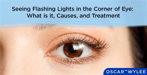 Flashing Lights In Eyes After Exercise