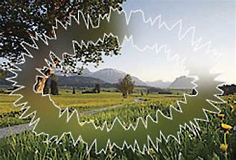 Flashing Zigzag Lines In My Vision