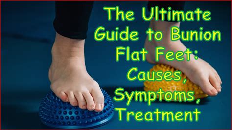 Flat Foot Bunion