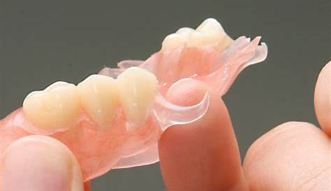 Valplast Flexible Dentures Swansea Romak Denture Centre