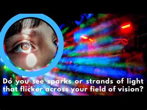 Flickering Lights In Visual Field
