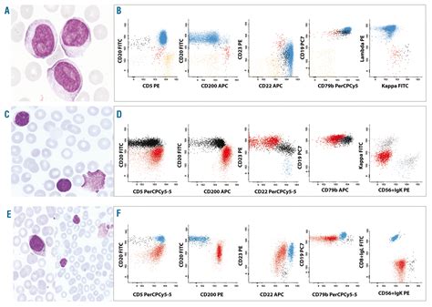 flow cytometry test for cll