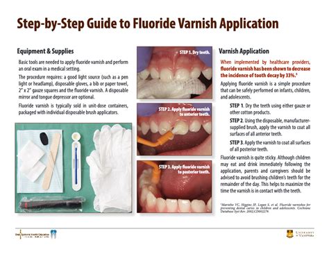 Fluoride Varnish Application Procedure And Post Operative Instructions