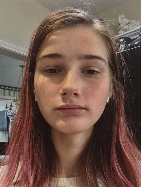 Flushed Cheeks Randomly