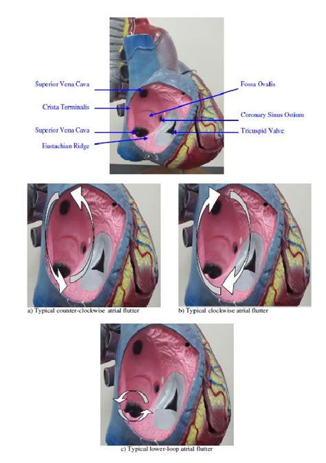 Flutter Left Side Stomach