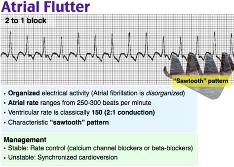 flutter.pulse rate