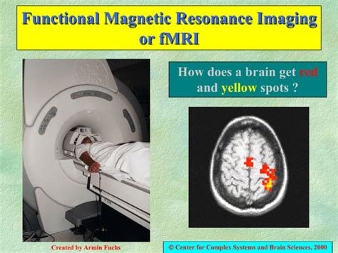 5 Ways FMRI Works
