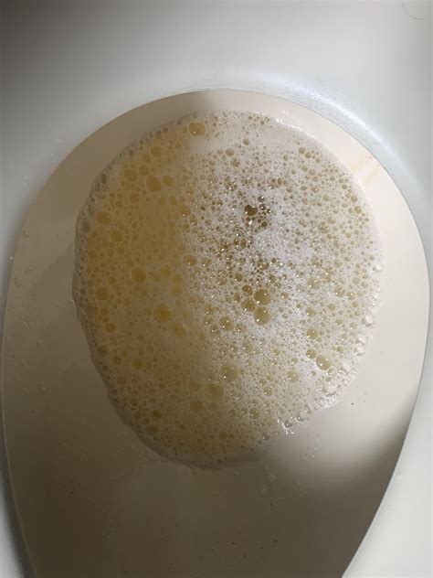 Foam In Pee Reddit