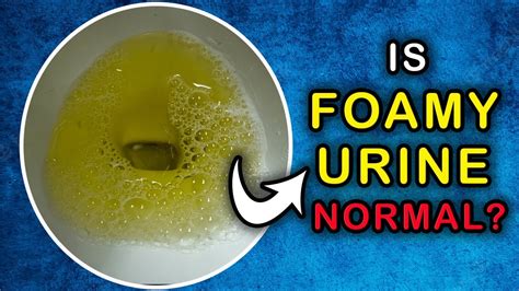 What Causes Foaming Urine in Men: Symptoms, Risks, and Treatment Options