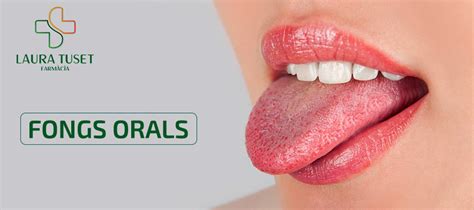 Viral Fongs A La Boca Update