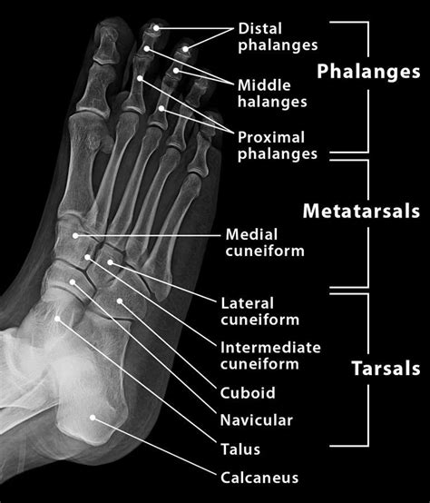 Foot Bones Xray Images