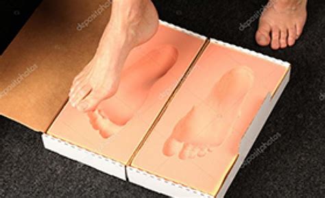 Foot Orthotics Casting