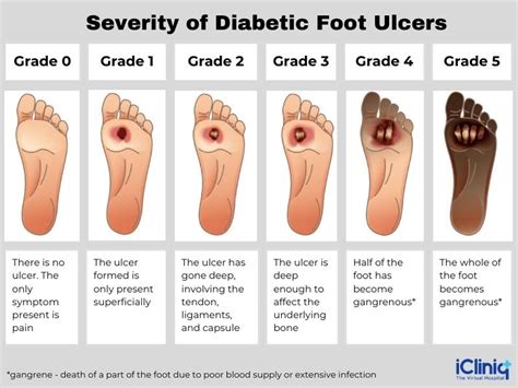 Foot Ulcer Definition